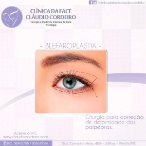 cirurgia de pálpebras