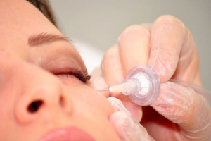Carboxiterapia facial
