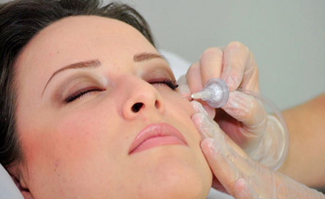 Carboxiterapia-facial Carboxiterapia-facial