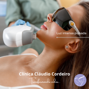 Mulher durante sessão de Luz intensa pulsada