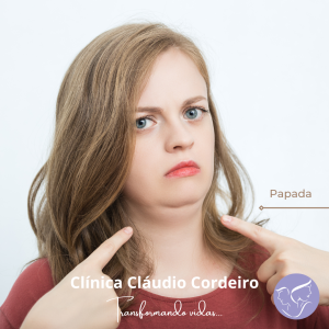 Tratamento de papada sem cirurgia