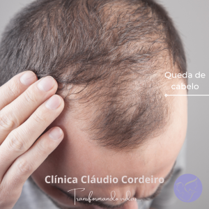 Queda de cabelo