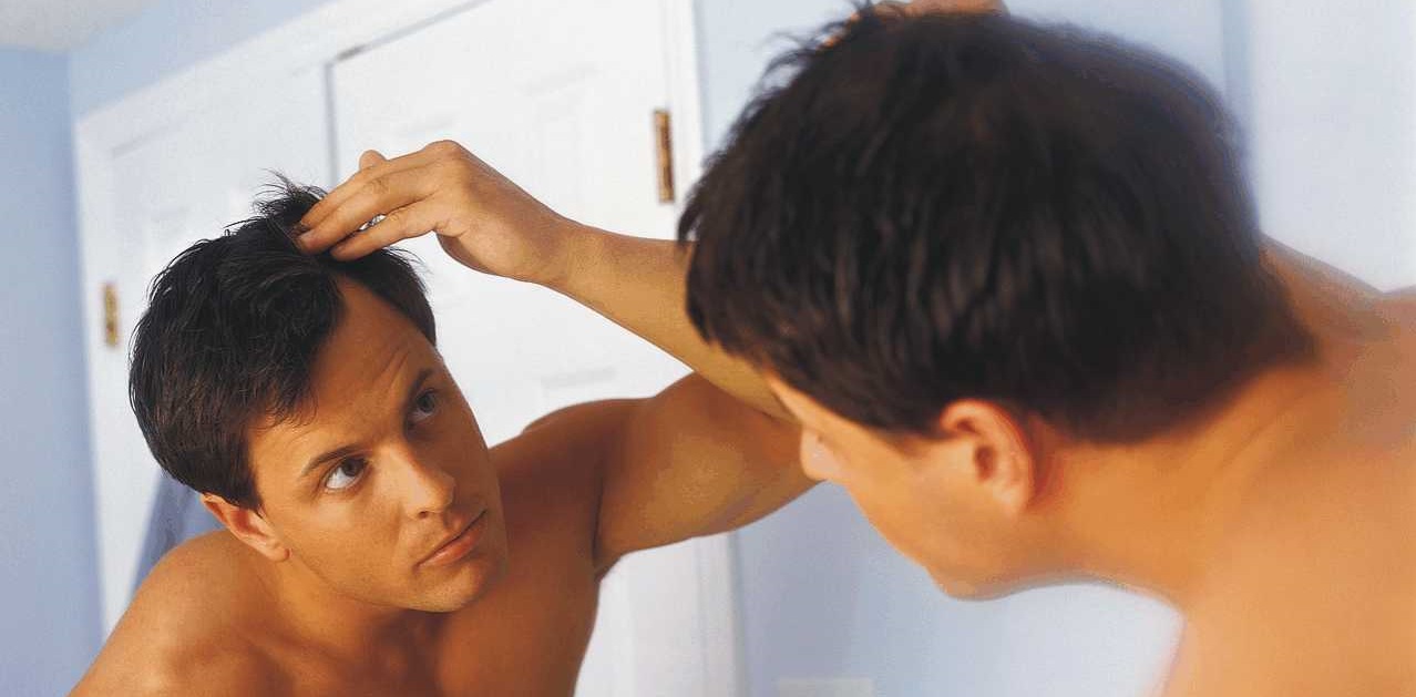 queda-de-cabelo-alopecia queda-de-cabelo-alopecia