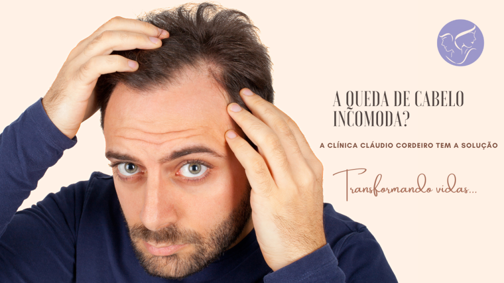 Alopecia masculina