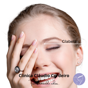 Glabela
Linhas entre as sobrancelhas