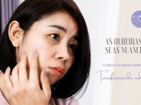 As olheiras e suas nuances