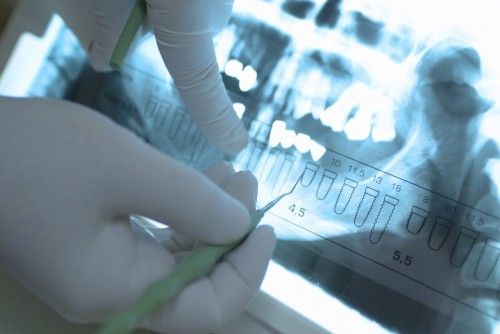 iStock_000002779609Large